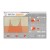 FabFilter Simplon